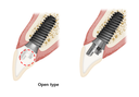 Osstem TS Link Abutment for Public Open Type