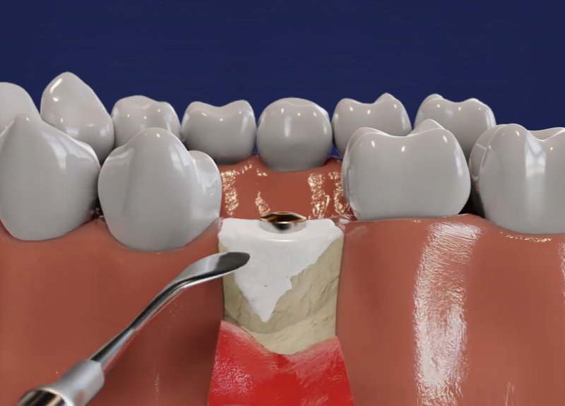 Ethoss-luudutusmateriaalin perusteet ja käyttö