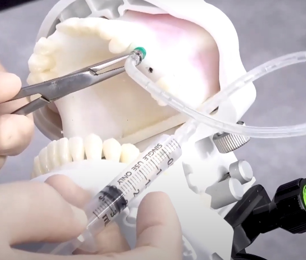 Osstem CAS-KIT - sinuslift perusteet 1